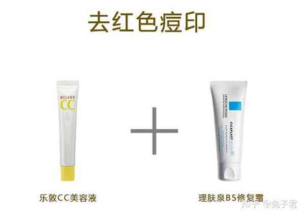 男脸上的痘印怎么去除(脸上的痘印能治好吗)照片 - 6 图片 - 6